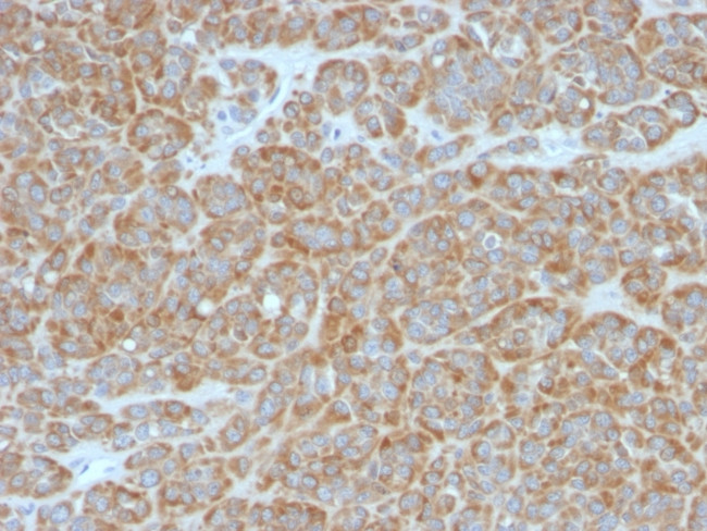 Bcl-2 (Apoptosis and Follicular Lymphoma Marker) Antibody in Immunohistochemistry (Paraffin) (IHC (P))