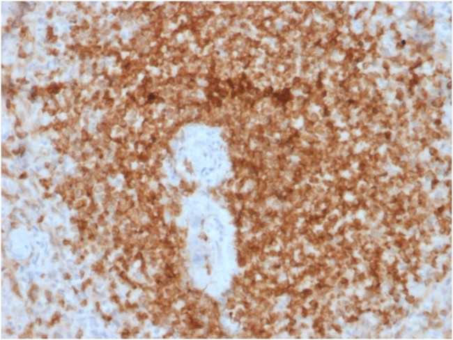 Bcl-2 Antibody in Immunohistochemistry (Paraffin) (IHC (P))