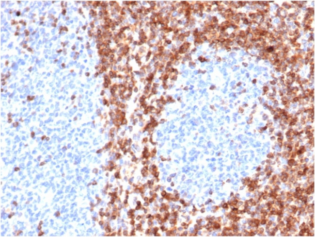 Bcl-2 Antibody in Immunohistochemistry (Paraffin) (IHC (P))