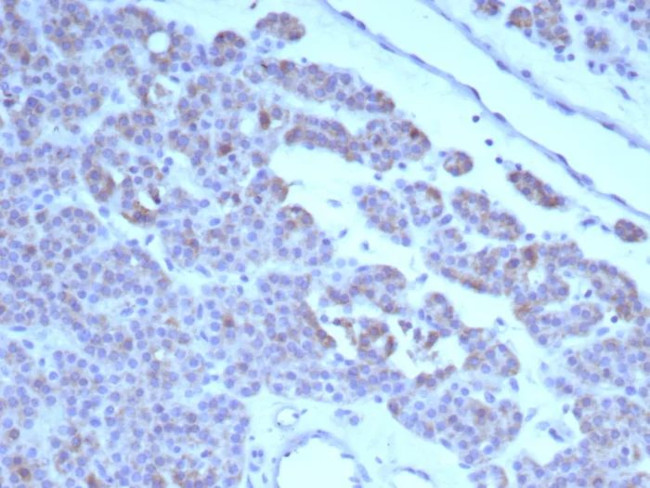 RET Proto-oncogene Antibody in Immunohistochemistry (Paraffin) (IHC (P))