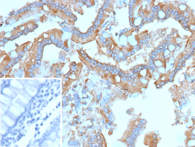 RET Proto-oncogene (Medullary Thyroid Carcinoma Marker) Antibody in Immunohistochemistry (Paraffin) (IHC (P))