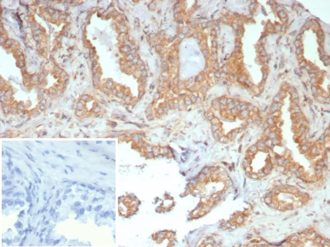 RET Proto-oncogene Antibody in Immunohistochemistry (Paraffin) (IHC (P))