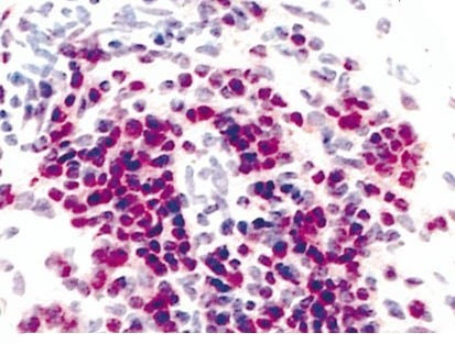 CXCR3 (CD183) Antibody in Immunohistochemistry (Paraffin) (IHC (P))