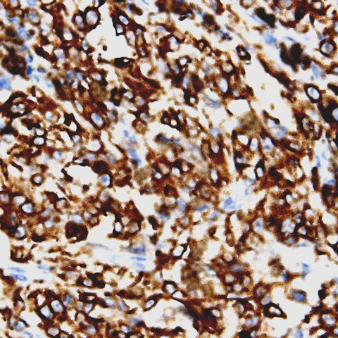 BCAR3 Antibody in Immunohistochemistry (Paraffin) (IHC (P))