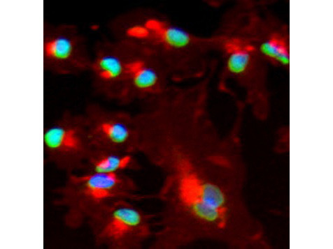 BMI1 Antibody in Immunocytochemistry (ICC/IF)