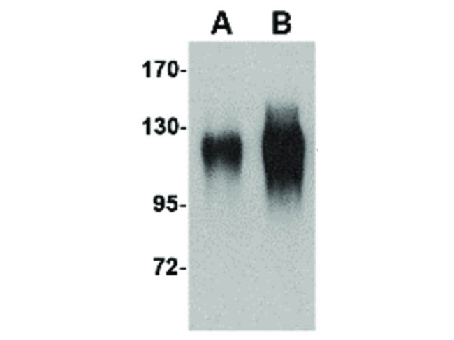 gp120 Antibody in Western Blot (WB)
