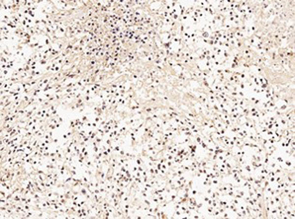 GRK2 Antibody in Immunohistochemistry (IHC)