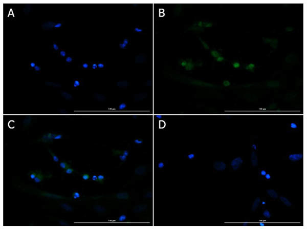 Brn3b Antibody in Immunocytochemistry (ICC/IF)