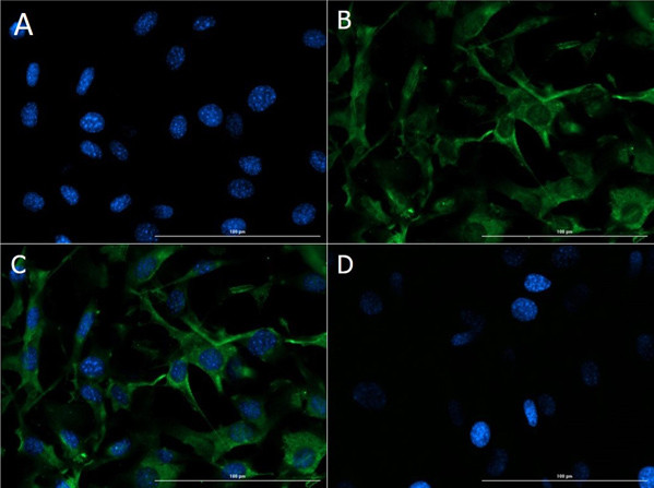 Collagen Type IV Antibody in Immunocytochemistry (ICC/IF)