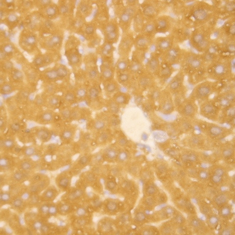 Midkine Antibody in Immunohistochemistry (Paraffin) (IHC (P))