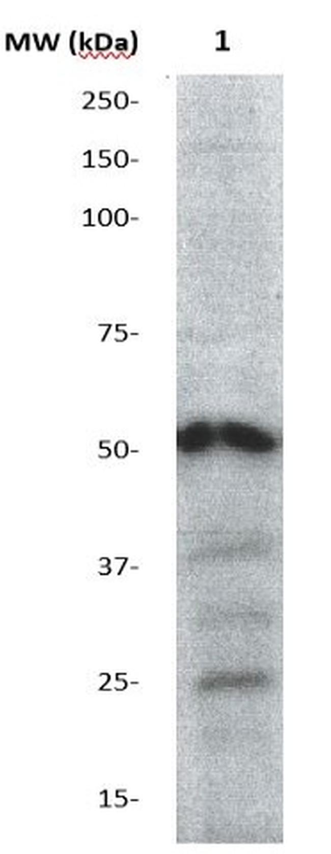 Phospho-AKT1/PKBa (Thr308) Antibody in Western Blot (WB)