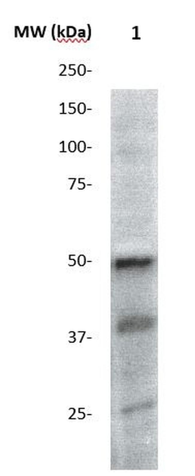 AKT3/PKBg Antibody in Western Blot (WB)