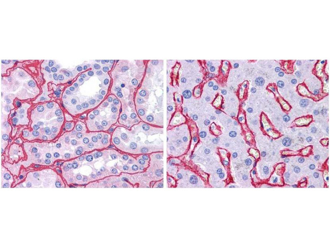 Collagen Type IV Antibody in Immunohistochemistry (Paraffin) (IHC (P))