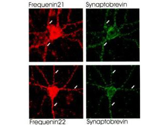 Frequenin Antibody in Immunocytochemistry (ICC/IF)
