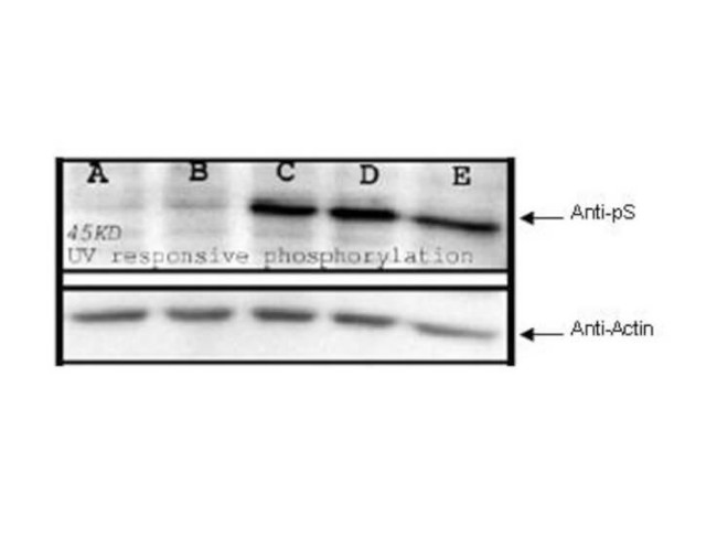 Phosphoserine Antibody in Western Blot (WB)