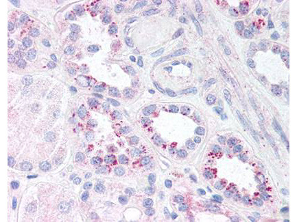 Phospho-NFkB (Ser536) Antibody in Immunohistochemistry (Paraffin) (IHC (P))