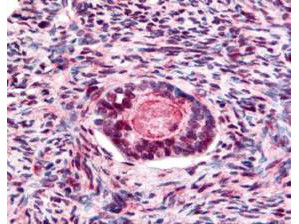 Phospho-GSK3 beta (Ser9) Antibody in Immunohistochemistry (Paraffin) (IHC (P))