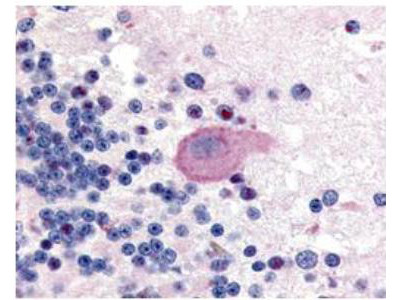 Phospho-Huntington (Ser421) Antibody in Immunohistochemistry (Paraffin) (IHC (P))