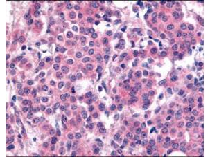 Phospho-PLK1 (Thr210) Antibody in Immunohistochemistry (Paraffin) (IHC (P))