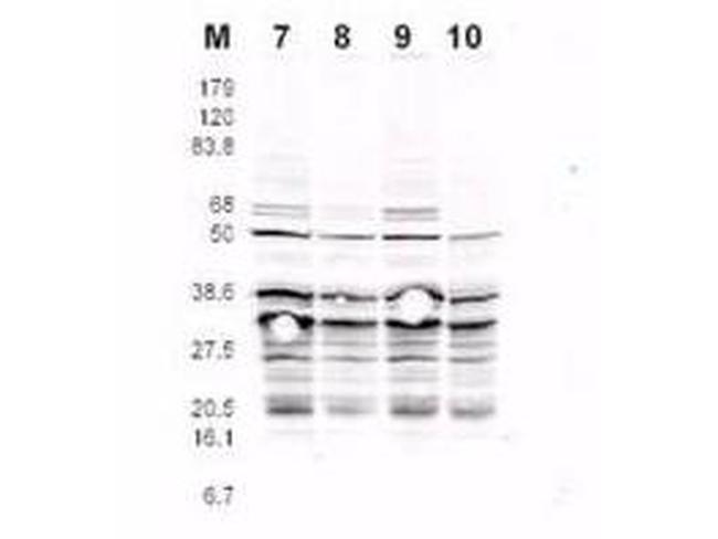 Phospho-RFA2 (Ser122) Antibody in Western Blot (WB)