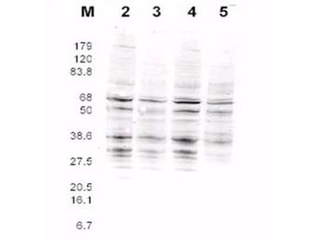RFA2 Antibody in Western Blot (WB)