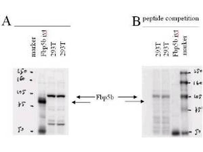 Fbp5B Antibody in Western Blot (WB)