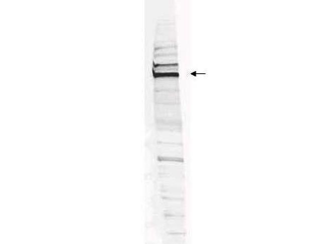 WHIP Antibody in Western Blot (WB)