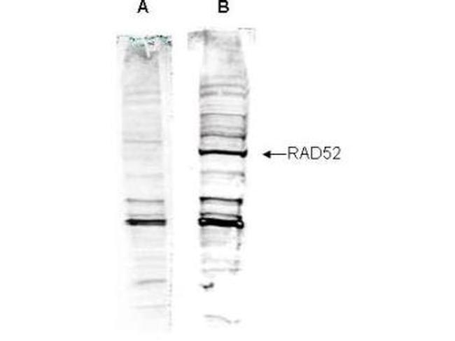RAD52 Antibody in Western Blot (WB)