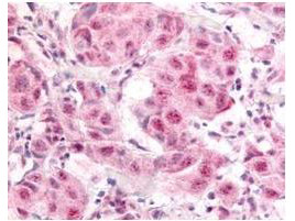 Phospho-E2F-1 (Ser364) Antibody in Immunohistochemistry (Paraffin) (IHC (P))