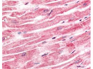 Sprouty-4 Antibody in Immunohistochemistry (Paraffin) (IHC (P))