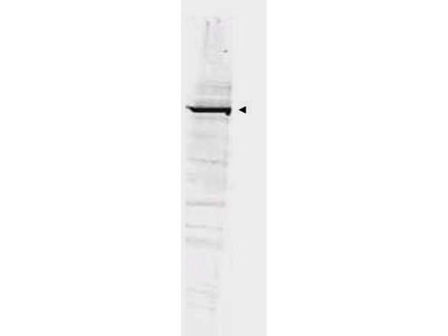 GGA1 Antibody in Western Blot (WB)