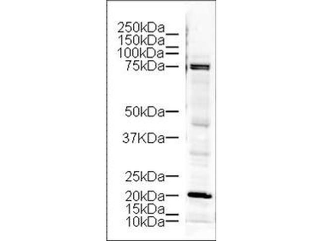 LIM Kinase Antibody in Western Blot (WB)