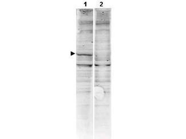 CaM Kinase II Antibody in Western Blot (WB)
