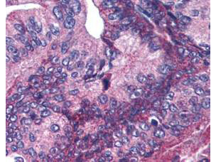 Phospho-APC1 (Ser377) Antibody in Immunohistochemistry (Paraffin) (IHC (P))