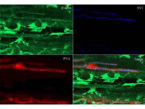 beta Actin Antibody in Immunohistochemistry (Paraffin) (IHC (P))