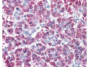Cbl-c Antibody in Immunohistochemistry (Paraffin) (IHC (P))