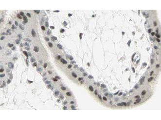 SMAD3 Antibody in Immunohistochemistry (Paraffin) (IHC (P))