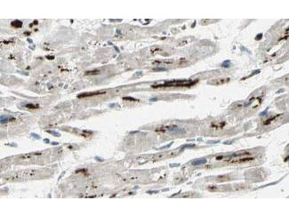 iASSP Antibody in Immunohistochemistry (Paraffin) (IHC (P))