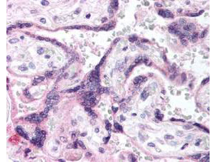 Phospho-EGFR (Tyr1197) Antibody in Immunohistochemistry (Paraffin) (IHC (P))