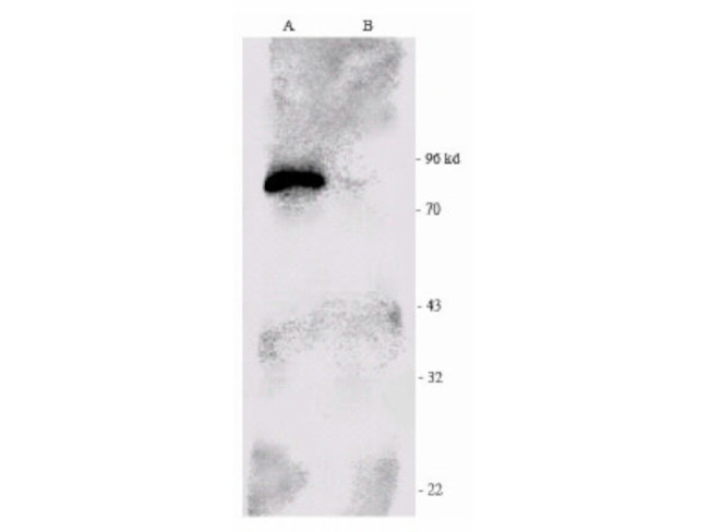 p90 RSK1 Antibody in Western Blot (WB)