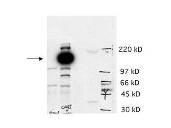 Cas5 Antibody in Western Blot (WB)
