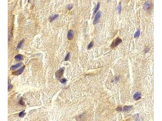 ECSIT Antibody in Immunohistochemistry (Paraffin) (IHC (P))