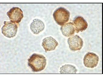 IRAK2 Antibody in Immunocytochemistry (ICC/IF)
