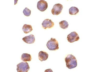 IRAK4 Antibody in Immunocytochemistry (ICC/IF)