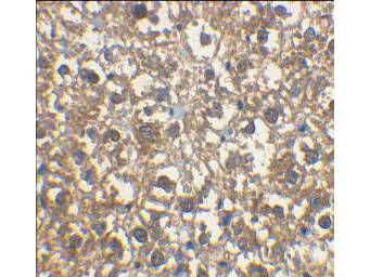 IRAK-M Antibody in Immunohistochemistry (Paraffin) (IHC (P))