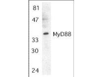 MyD88 Antibody in Western Blot (WB)
