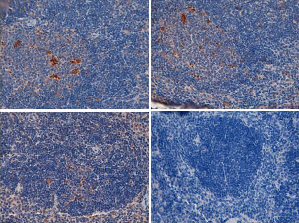 TLR2 Antibody in Immunohistochemistry (Paraffin) (IHC (P))