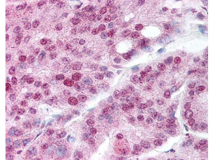 Acetyl-HSP90 (Lys294) Antibody in Immunohistochemistry (Paraffin) (IHC (P))