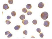 Death Receptor 4 Antibody in Immunocytochemistry (ICC/IF)