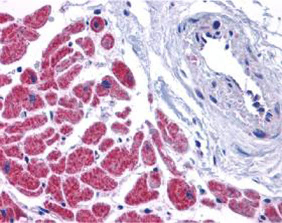 Caspase-12 Antibody in Immunohistochemistry (Paraffin) (IHC (P))
